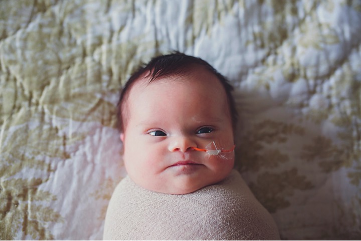 mj-godupdates-newborn-with-brain-tumor-2